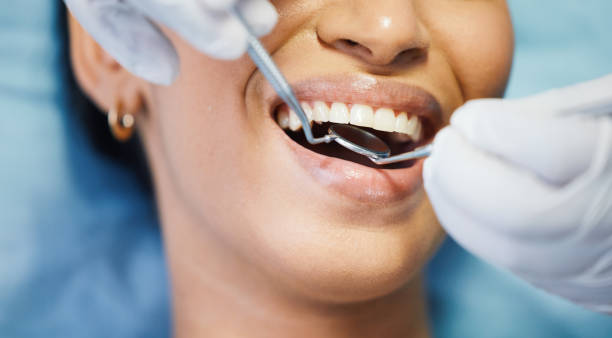 Best Root Canal Emergency Dentist  in Forest Ranch, CA